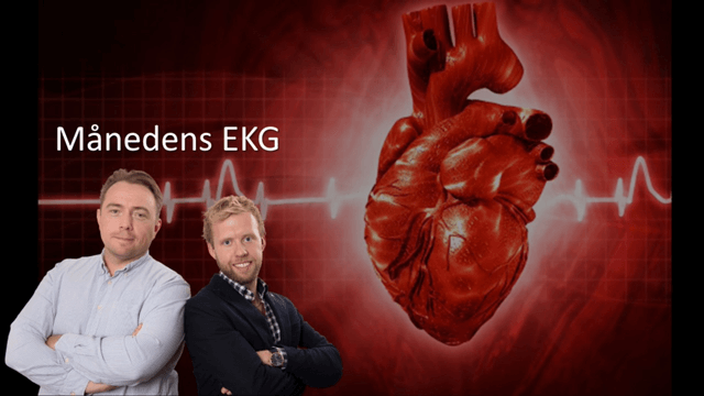 Månedens EKG